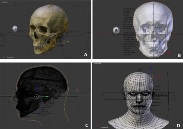 Imagem computadorizada das etapas da reconstrução facial 